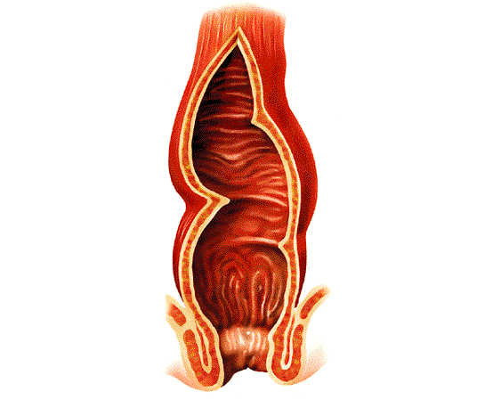 El recto es la parte distal del intestino grueso