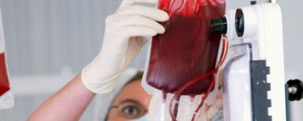 Reanimación con hemoderivados en pacientes con hemorragia masiva
