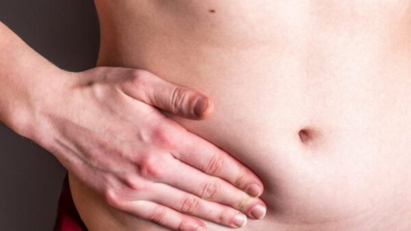 ¿Qué es una hernia reducible?