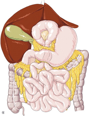 Hernia externa vs hernia interna