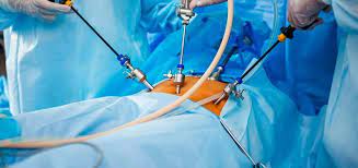 ¿Qué significa el término laparoscopia?